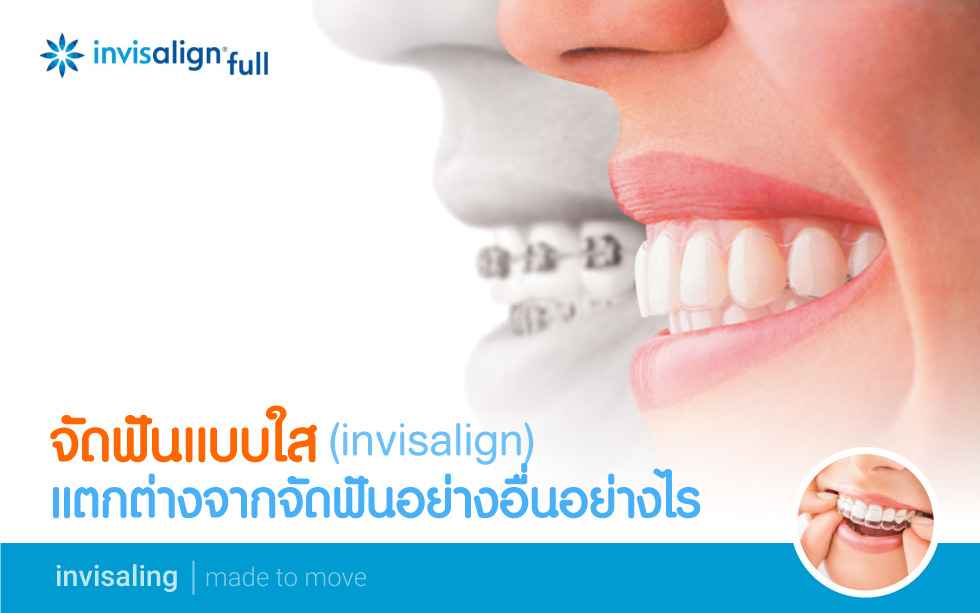 จัดฟันแบบใส invisalign แตกต่างจากการจัดฟันอย่างอื่นอย่างไร