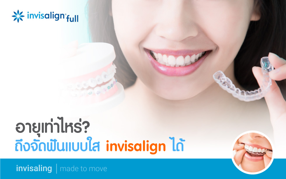 อายุเท่าไหร่ถึงจัดฟันแบบใส invisalign ได้