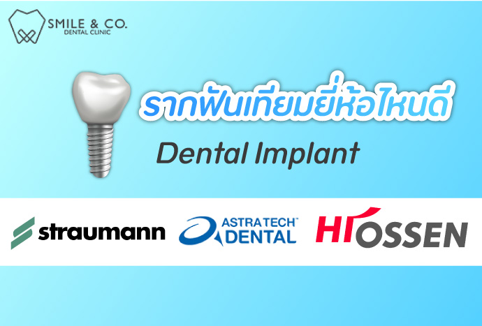 รากฟันเทียมยี่ห้อไหนดี-ที่เหมาะสมกับคุณมากที่สุด