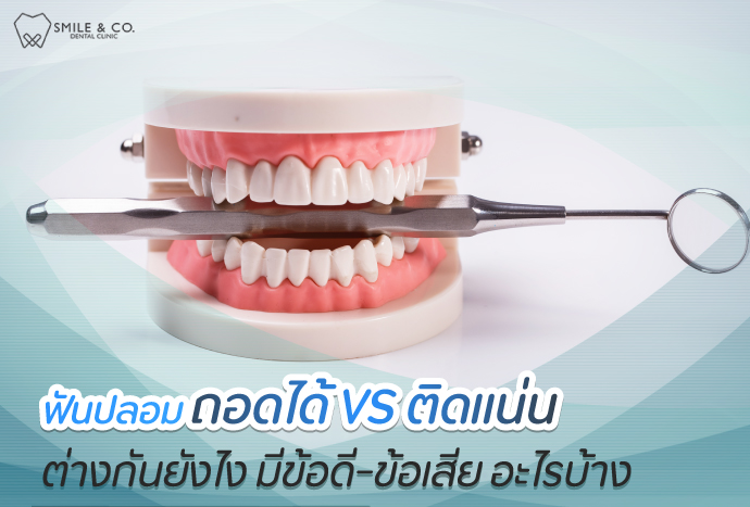 ฟันปลอม-ถอดได้-ติดแน่น-แตกต่างกันยังไง-มีข้อดี-ข้อเสีย-อะไรบ้าง