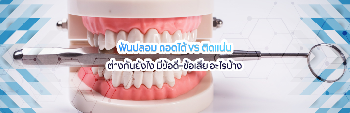 ฟันปลอม-ถอดได้-แตกต่างกับติดแน่น-อย่างไร