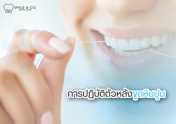 การปฏิบัติตัวหลังขูดหินปูน