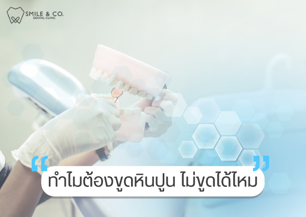 ทำไมต้องขูดหินปูน-ไม่ขูดได้ไหม