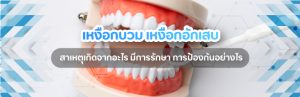เหงือกบวม-เหงือกอักเสบ-สาเหตุเกิดจากอะไรพร้อมวิธีการรักษา-ป้องกัน