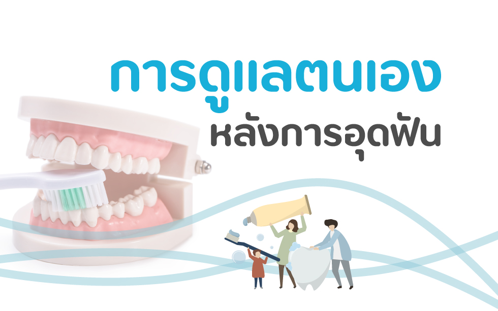 การดูแลตนเองหลังการอุดฟัน