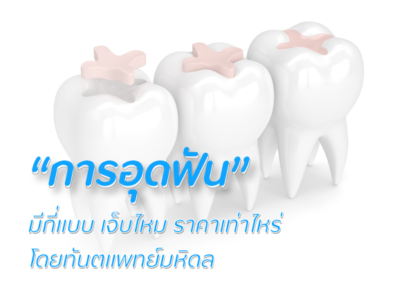 การอุดฟัน-มีกี่แบบ-เจ็บไหม-ราคาเท่าไหร่-โดยทันตแพทย์มหิดล