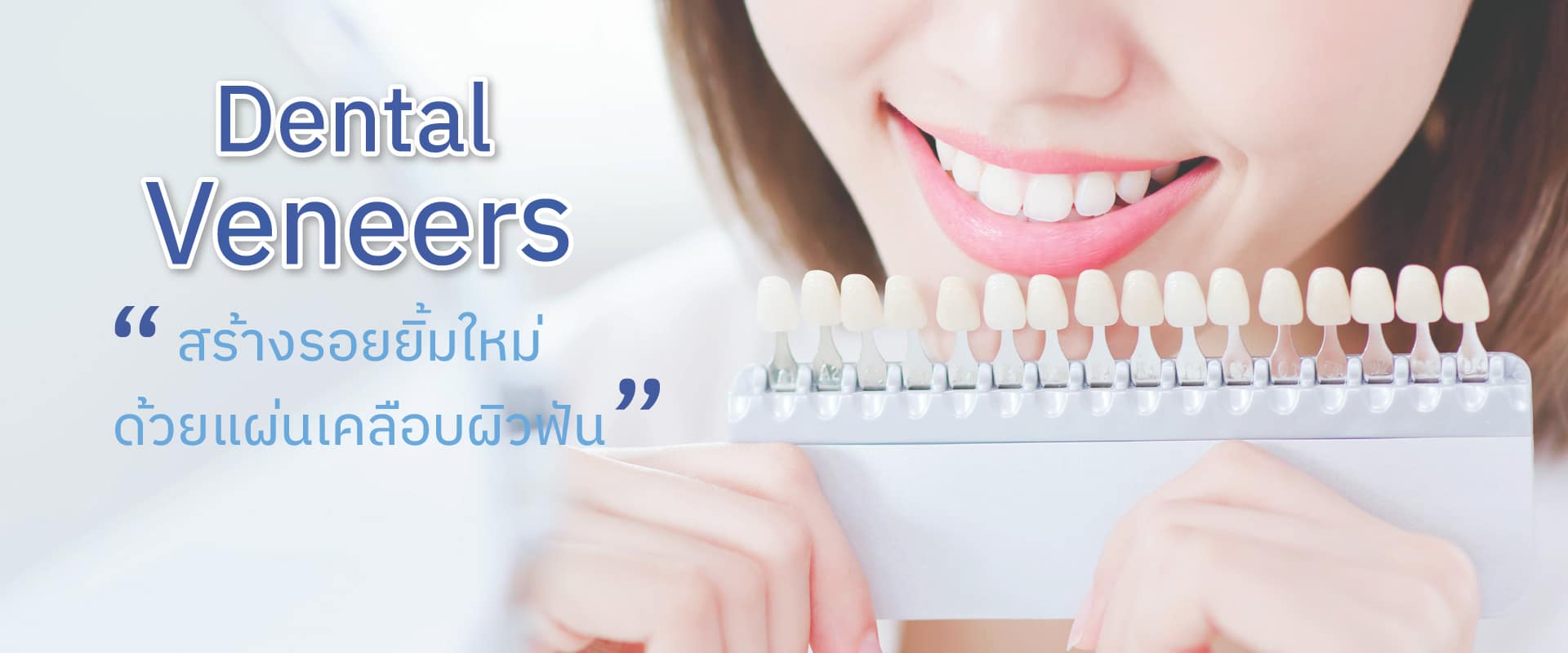 banner-dental-veneers