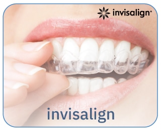 บริการ-จัดฟันแบบใส-invisalign