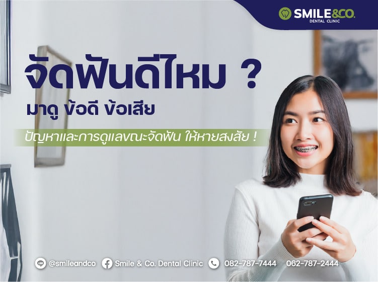 จัดฟันดีไหม