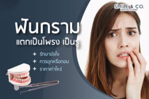 ฟันกรามแตกเป็นโพรง เป็นรู รักษายังไง ควรอุดหรือถอน