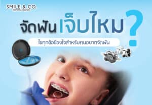 จัดฟันเจ็บไหม ไขทุกข้อข้องใจสำหรับคนอยากจัดฟัน