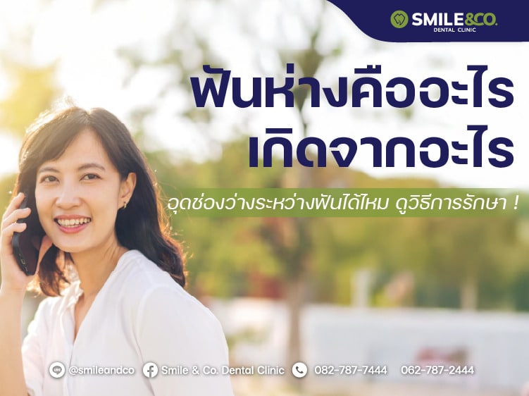 ฟันห่าง คืออะไร เกิดจากอะไร วิธีรักษา
