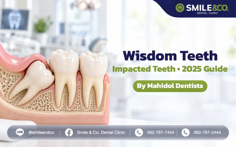 Wisdom Teeth (Impacted Teeth) 2025 Guide by Mahidol Dentists