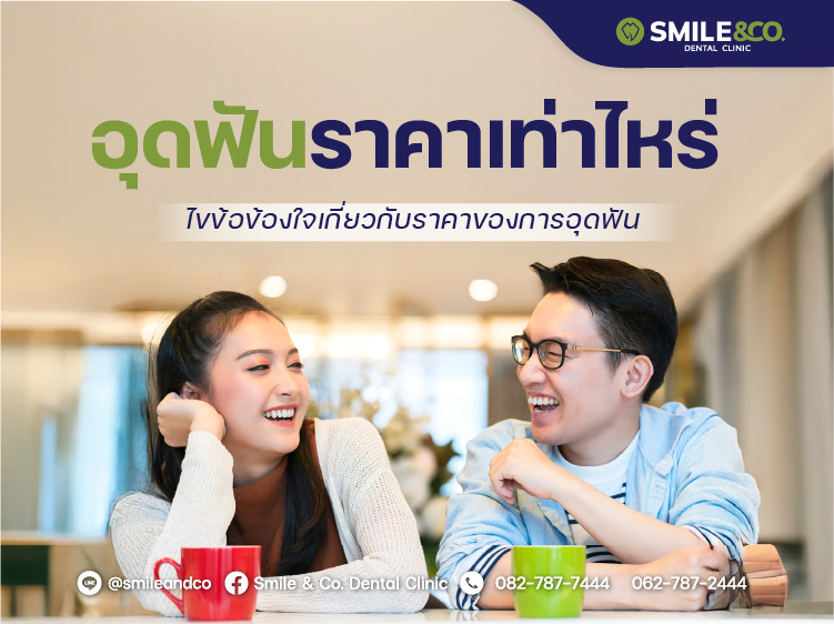 อุดฟัน ราคาเท่าไหร่