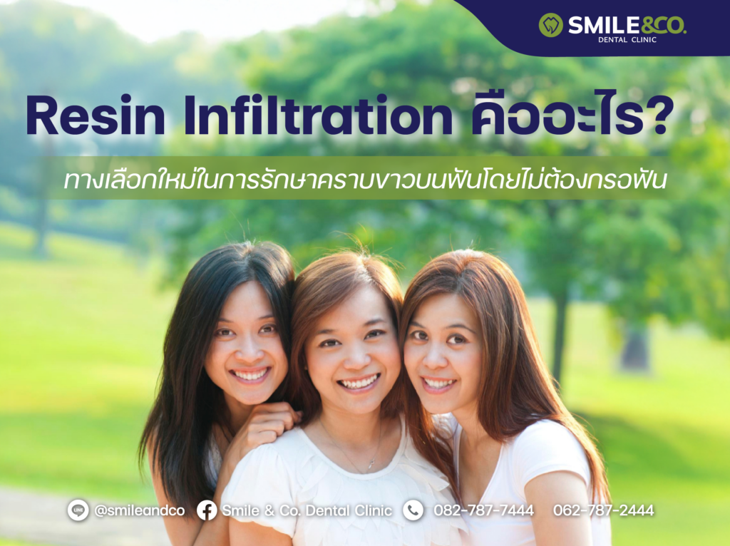 Resin Infiltration คืออะไร