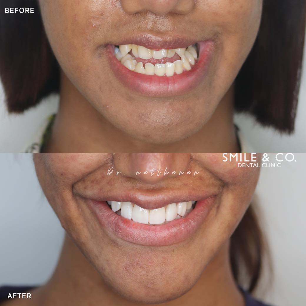 jaw-surgery-case-reviews-01