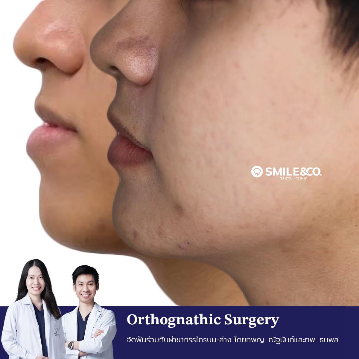 jaw-surgery-case-reviews-03