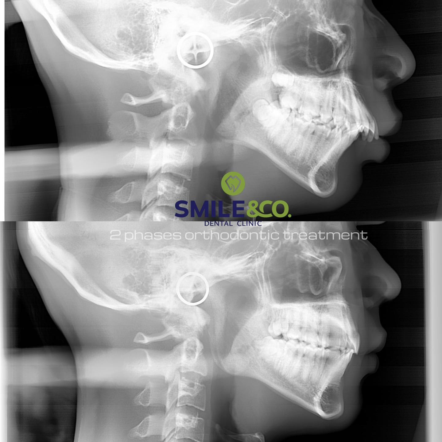 kids-braces-case-reviews-02