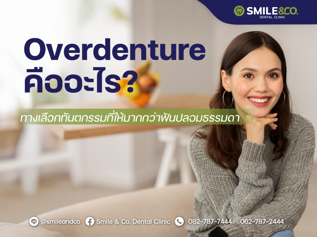 Overdenture คืออะไร