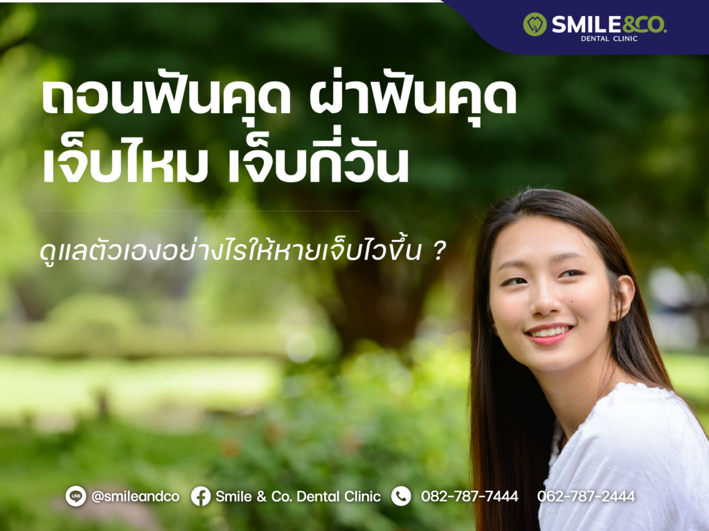 ถอนฟันคุด ผ่าฟันคุด เจ็บไหม เจ็บกี่วัน