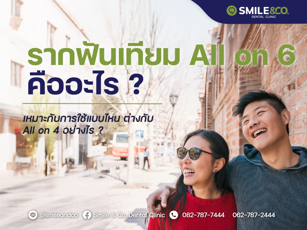 รากฟันเทียม All on 6 คืออะไร