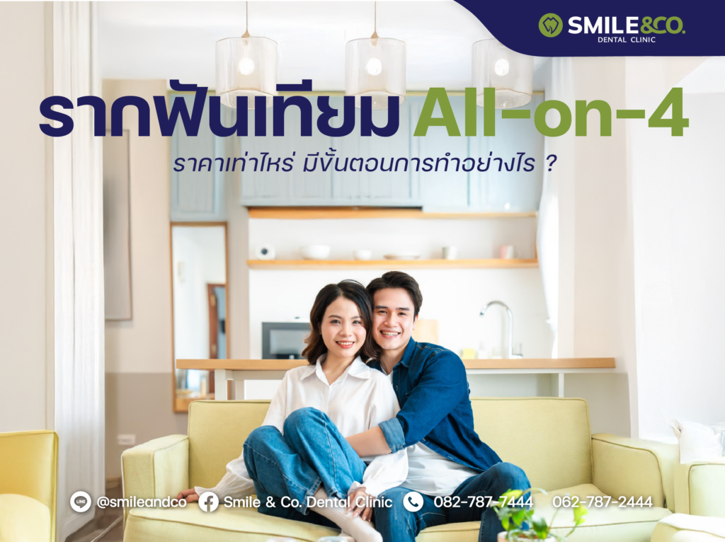 รากฟันเทียม All-on-4