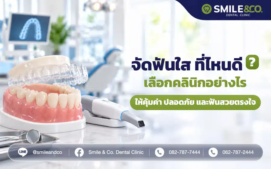 จัดฟันใส ที่ไหนดี ฟันสวยตรงใจ บอกวิธีเลือกคลินิกจัดฟันแบบใสให้คุ้มค่าและปลอดภัย