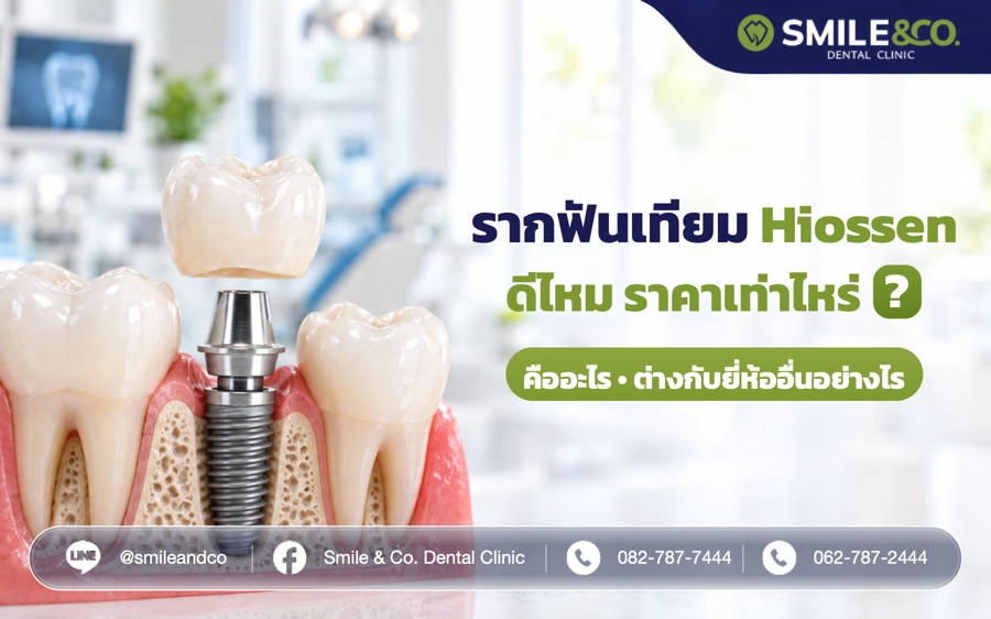 รากฟันเทียม Hiossen คืออะไร ดีไหม ราคาเท่าไหร่ ?