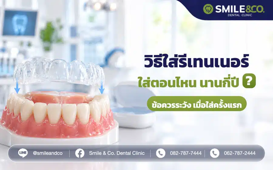 วิธีใส่รีเทนเนอร์ ทำอย่างไร ? ใส่ครั้งแรกระวังอะไรบ้าง ใส่ตอนไหน นานกี่ปี ?