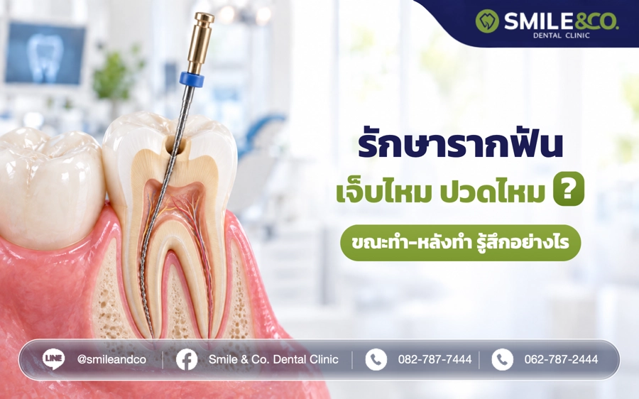 รักษารากฟัน เจ็บไหม ปวดไหม ?