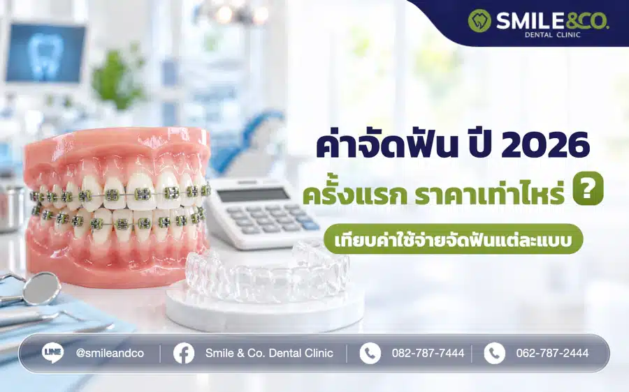 ค่าจัดฟัน ราคาเท่าไหร่ ปี 2026 ทำครั้งแรกกี่บาท แต่ละแบบแพงไหม ?