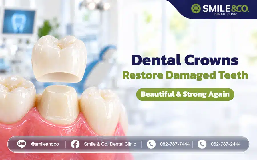 Dental Crowns: Restore Damaged Teeth to Be Beautiful and Strong Again
