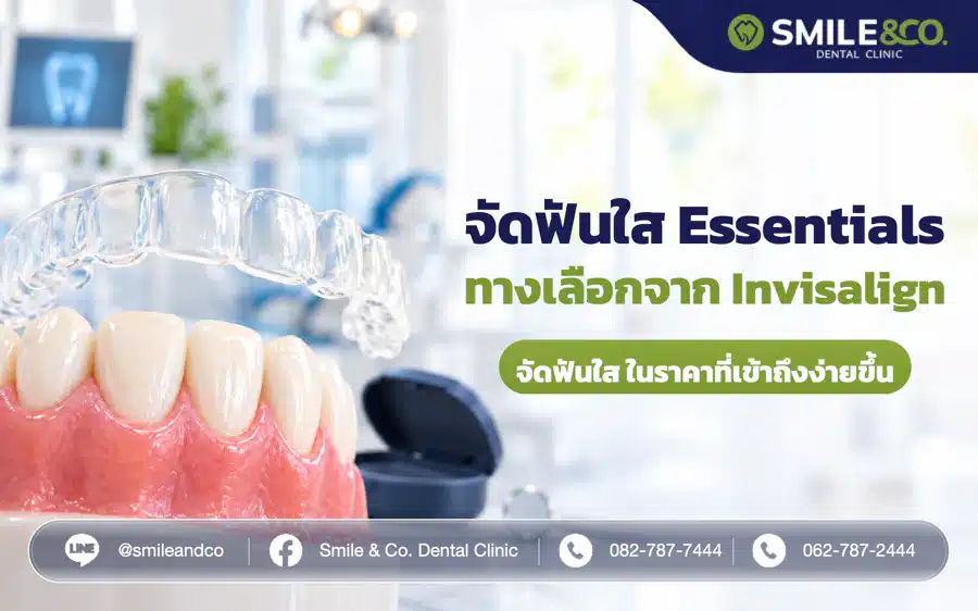 จัดฟันใส Essentials ทางเลือกการจัดฟันใสจากแบรนด์ Invisalign ในราคาที่ถูกลง