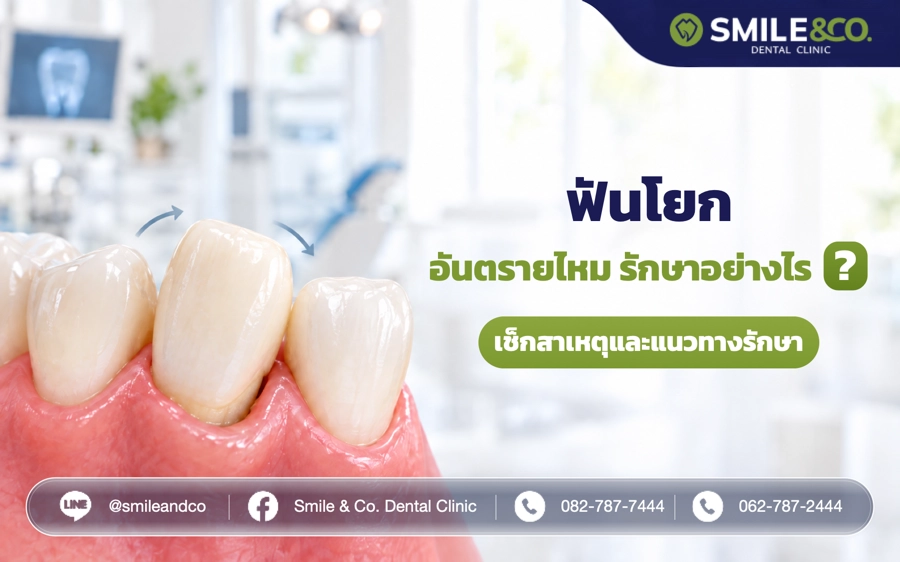 ฟันโยก อันตรายไหม รักษาอย่างไร ?