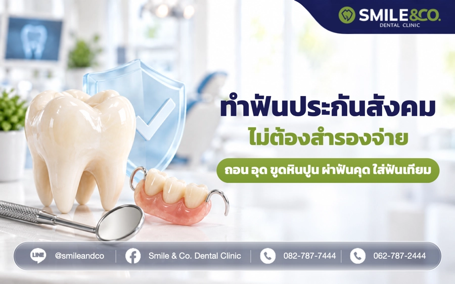 ทำฟันประกันสังคม ไม่ต้องสำรองจ่าย