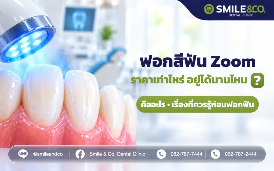 ฟอกสีฟัน Zoom คืออะไร ฟอกฟันขาวอยู่ได้นานไหม ราคาเท่าไหร่ ?