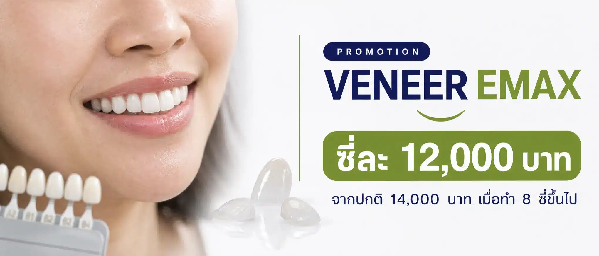 วีเนียร์-emax-ราคา-12000-บาท-8-ซี่ขึ้นไป