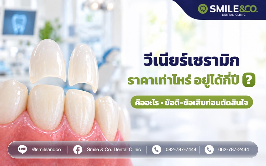 วีเนียร์เซรามิก ราคาเท่าไหร่ อยู่ได้กี่ปี ?