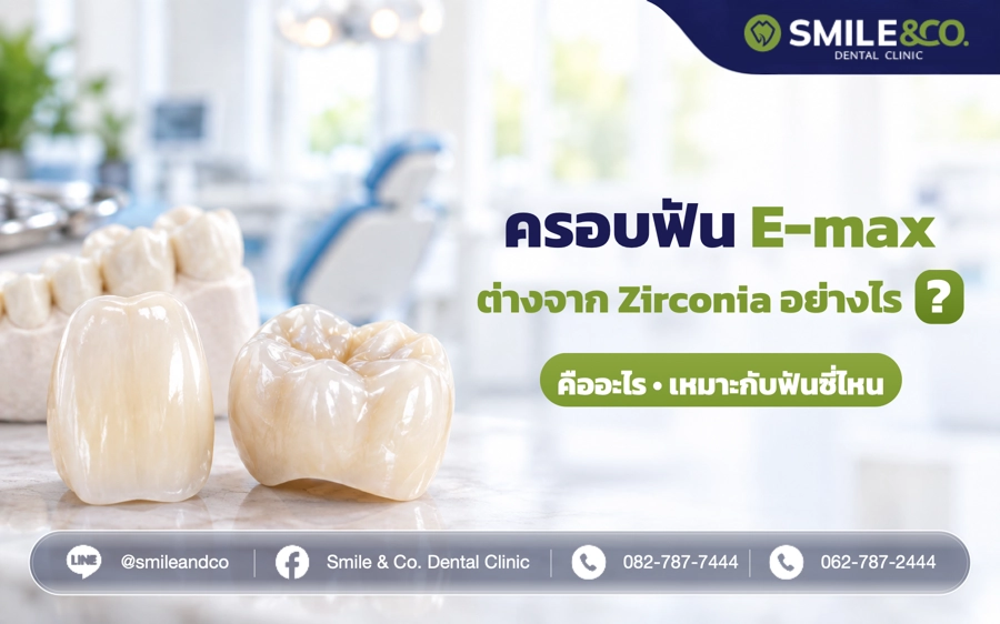 ครอบฟัน E-max ต่างจาก Zirconia อย่างไร