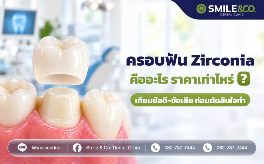 ครอบฟัน Zirconia คืออะไร ราคาเท่าไหร่ ? เทียบข้อดี-ข้อเสียก่อนตัดสินใจทำ